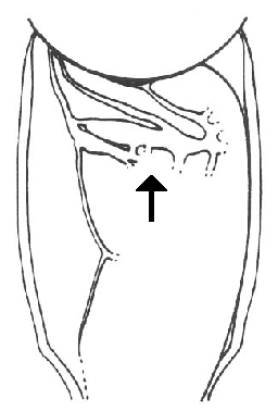 image of Neoconocephalus lyristes